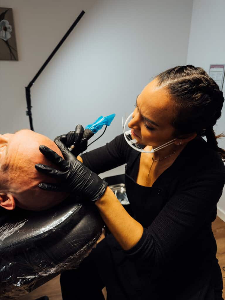 Noëmie réalisant une séance de tricopigmentation capillaire