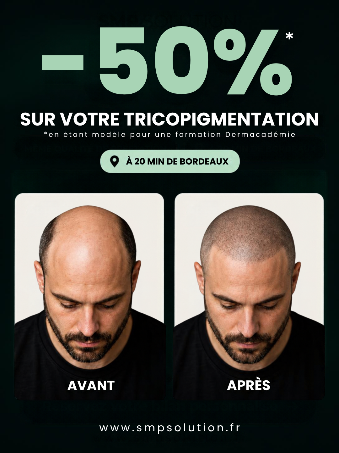 Visuel de l’offre modèle Dermacadémie : moins 50 % sur la tricopigmentation, à 20 minutes de Bordeaux
